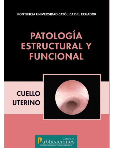 Patología estructural y funcional. Cuello uterino