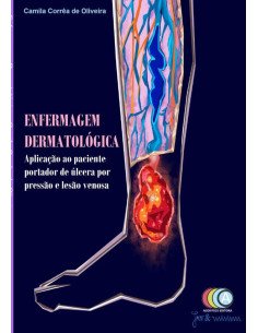 Enfermagem Dermatológica:Aplicação ao paciente portador de úlcera por pressão e lesão venosa