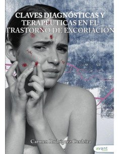 Claves diagnósticas y terapéuticas en el trastorno de excoriación
