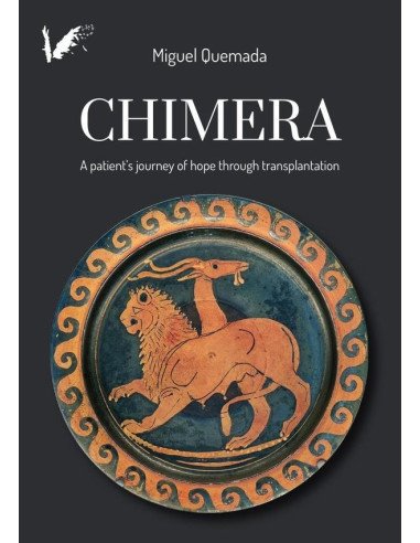 Chimera:A patient's journey of hope through transplantation
